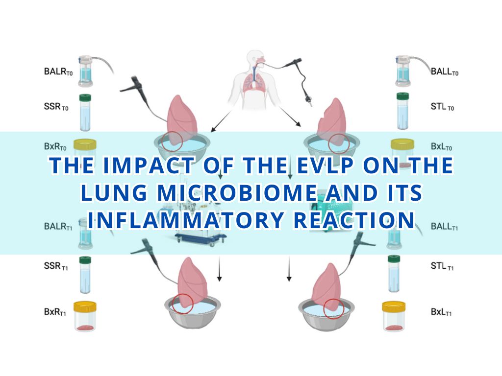 The impact of the EVLP on the lung microbiome and its inflammatory reaction